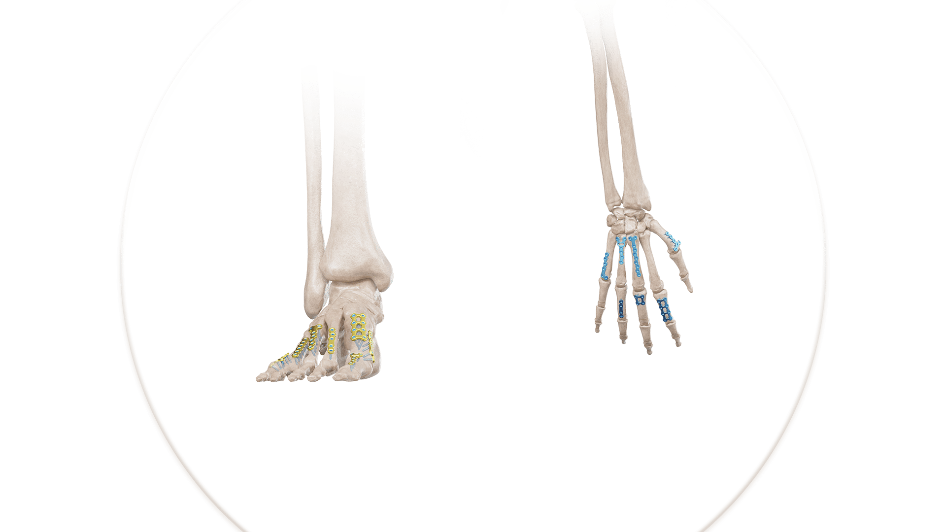 Mini Plaklar