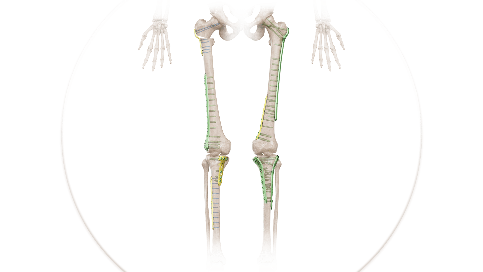 Tibia & Femur