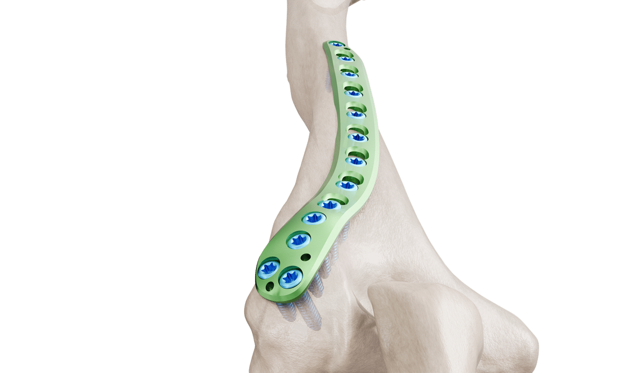 Distal Humerus Posterolateral Plak