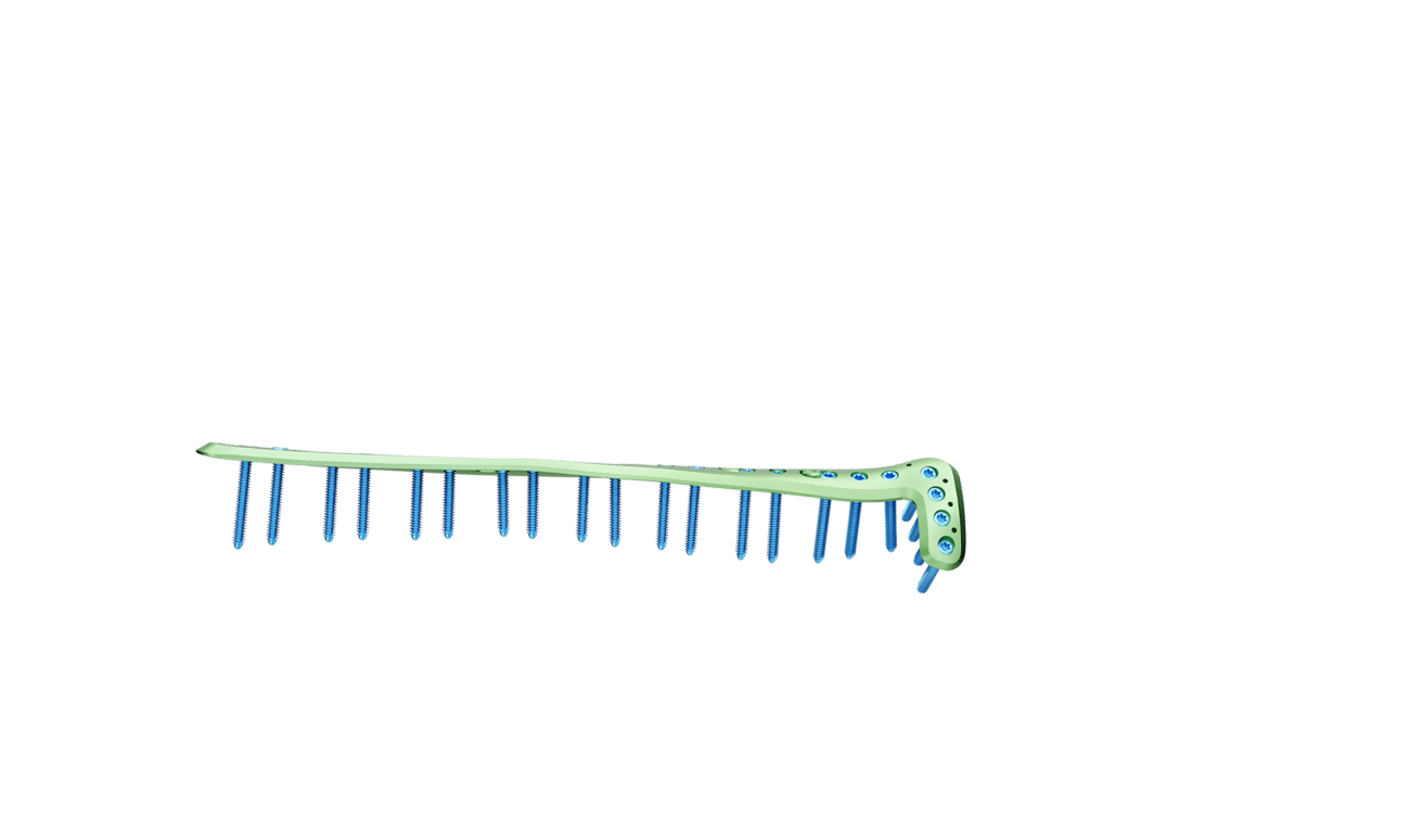Distal Tibia Anterolateral Anatomik Plak