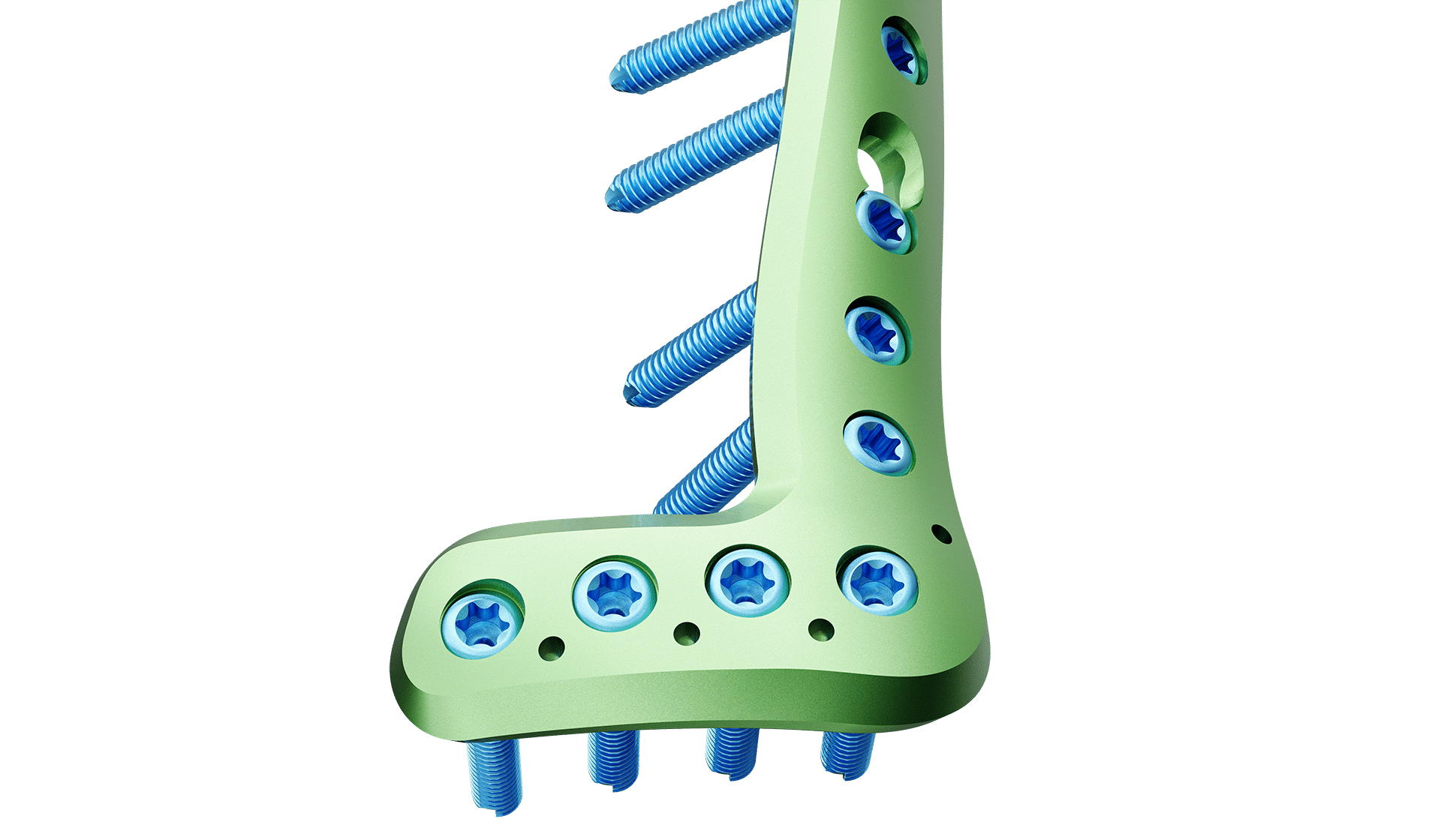 Distal Tibia Anterolateral Anatomik Plak