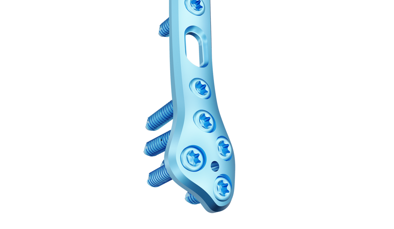 Distal Fibula Posterolateral Anatomik Plak
