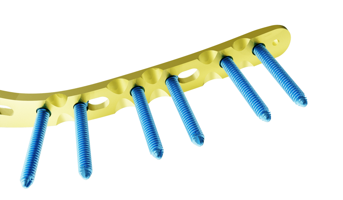 Proksimal Tibia Posteromedyal Plak