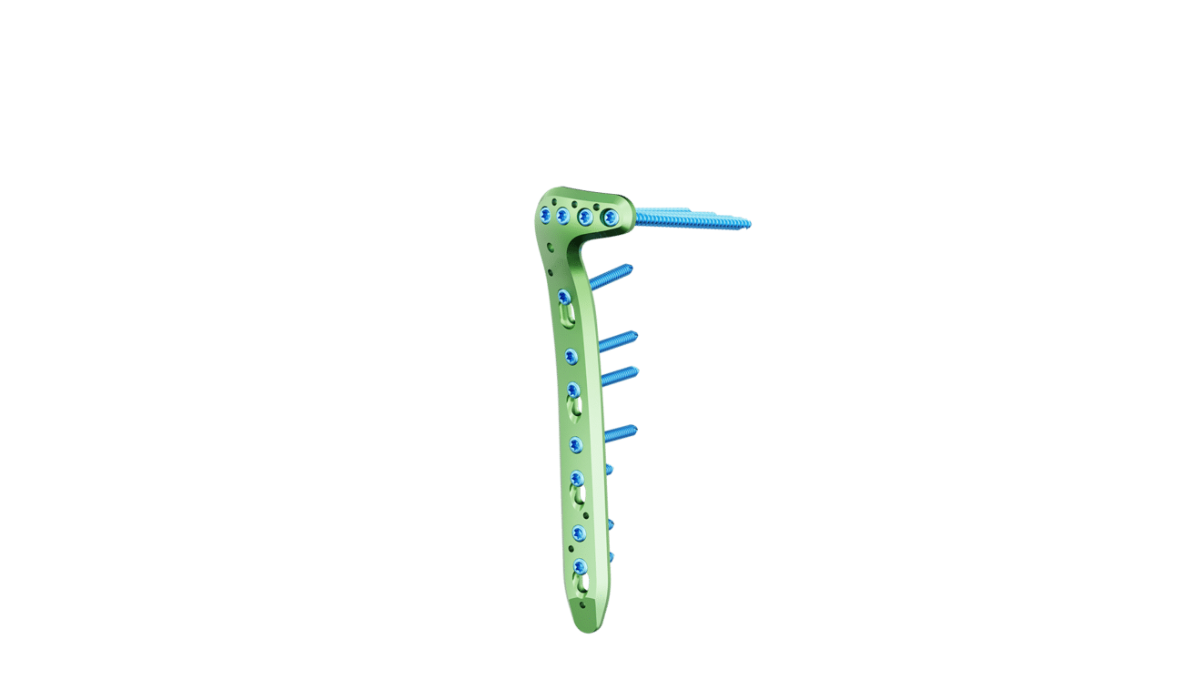 Proksimal Tibia Lateral Anatomik Plak