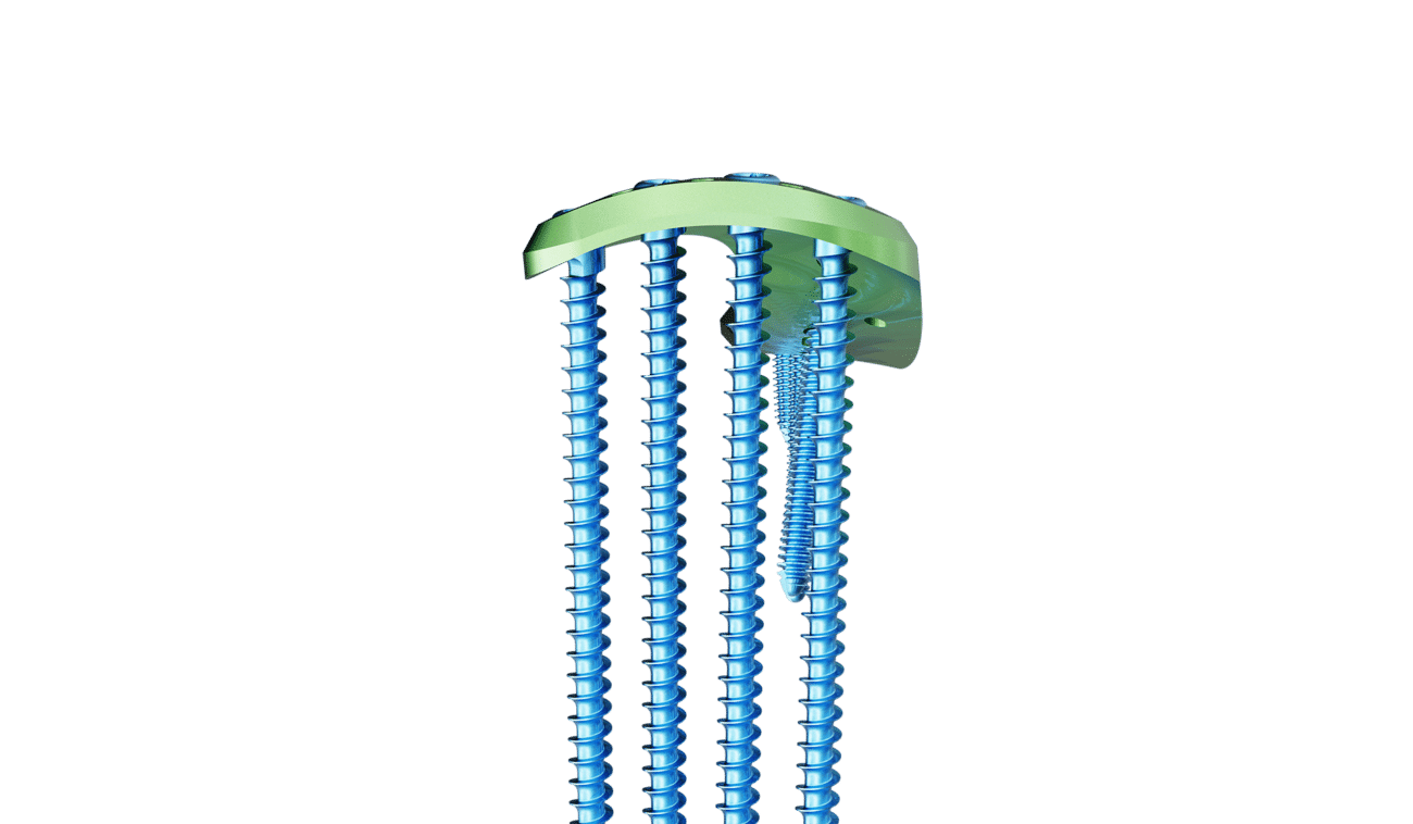 Proksimal Tibia Lateral Anatomik Plak