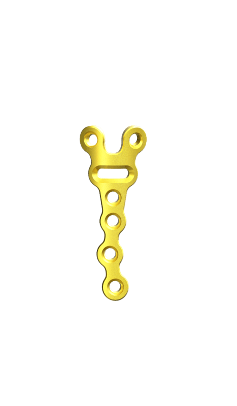 2.0 mm Mini Plaklar