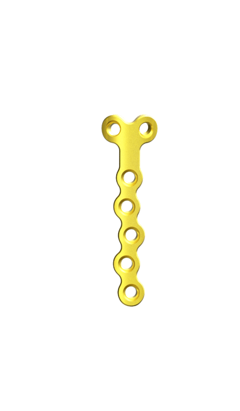 2.0 mm Mini Plaklar