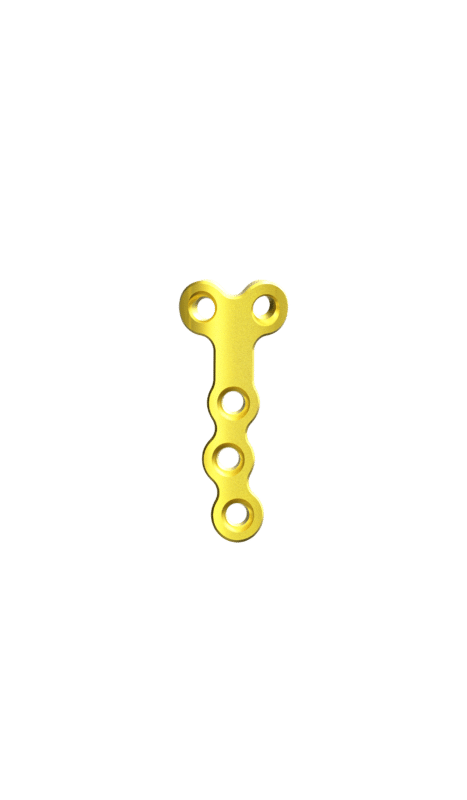 2.0 mm Mini Plaklar