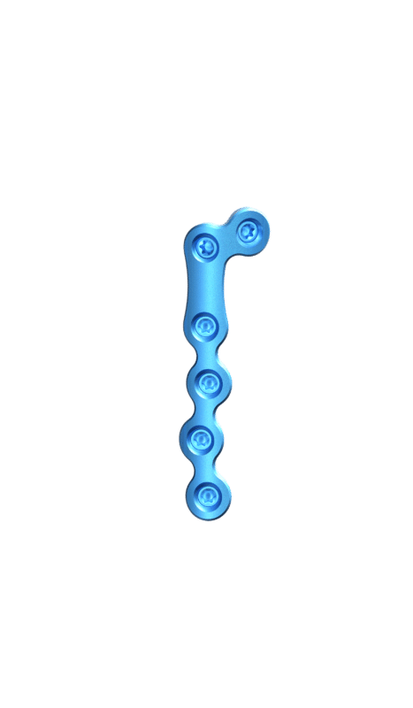 1.5 mm Mini Plaklar